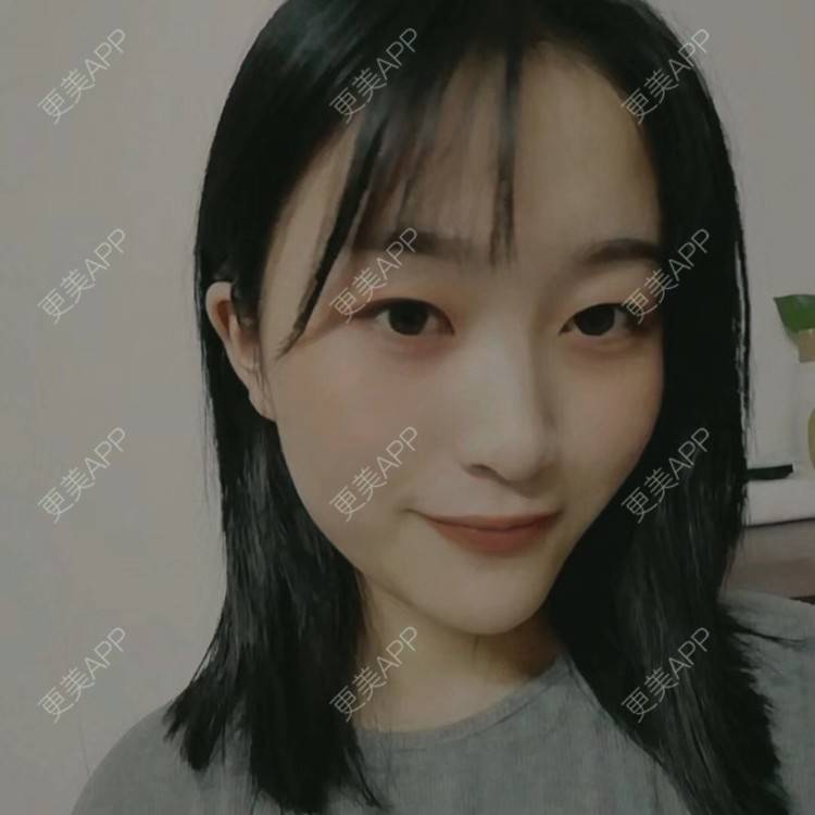 更美 - 欣欣的后花园的激光淡斑经验 | 皮秒激光 | 激光淡斑 | 武汉