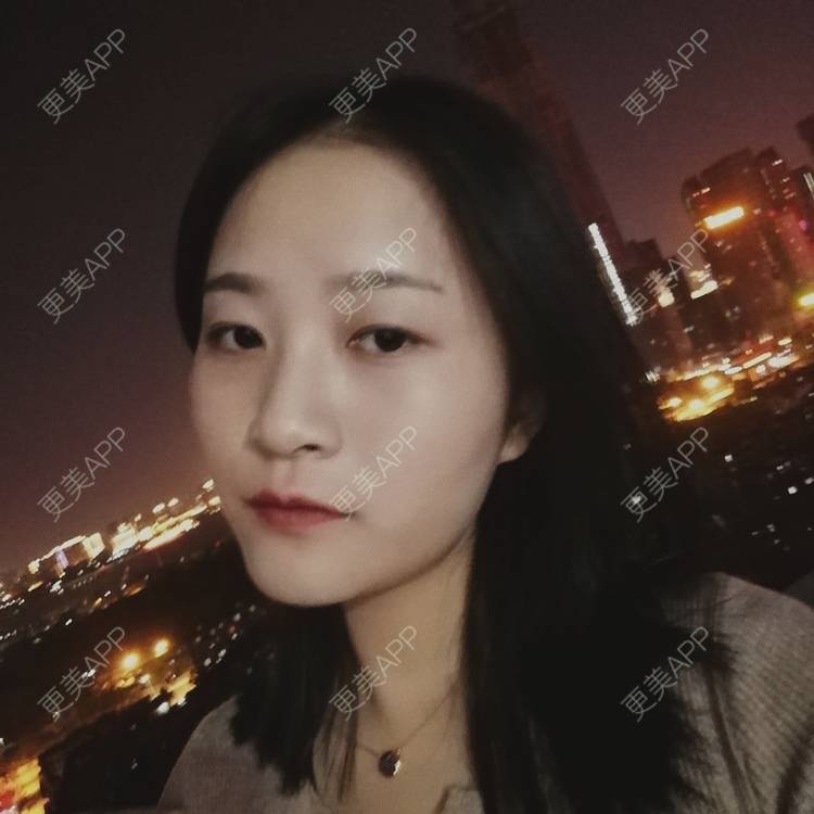 更美 - 欣欣的后花园的激光淡斑经验 | 皮秒激光 | 激光淡斑 | 武汉