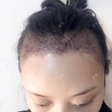 更美用户PkjDqlmGSW