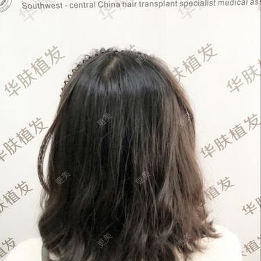 更美用户PkjDqlmGSW