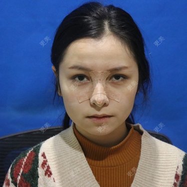 温情火光