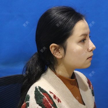 温情火光