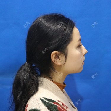 温情火光