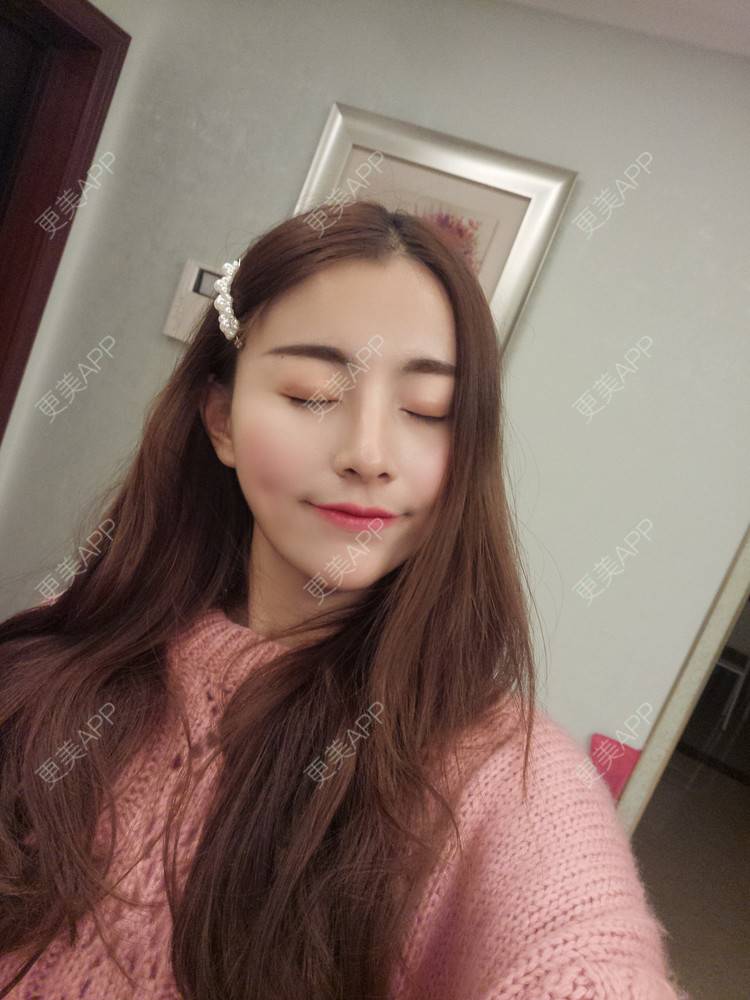更美 - YOYO球的镭射净肤经验 | 镭射净肤 | 广州