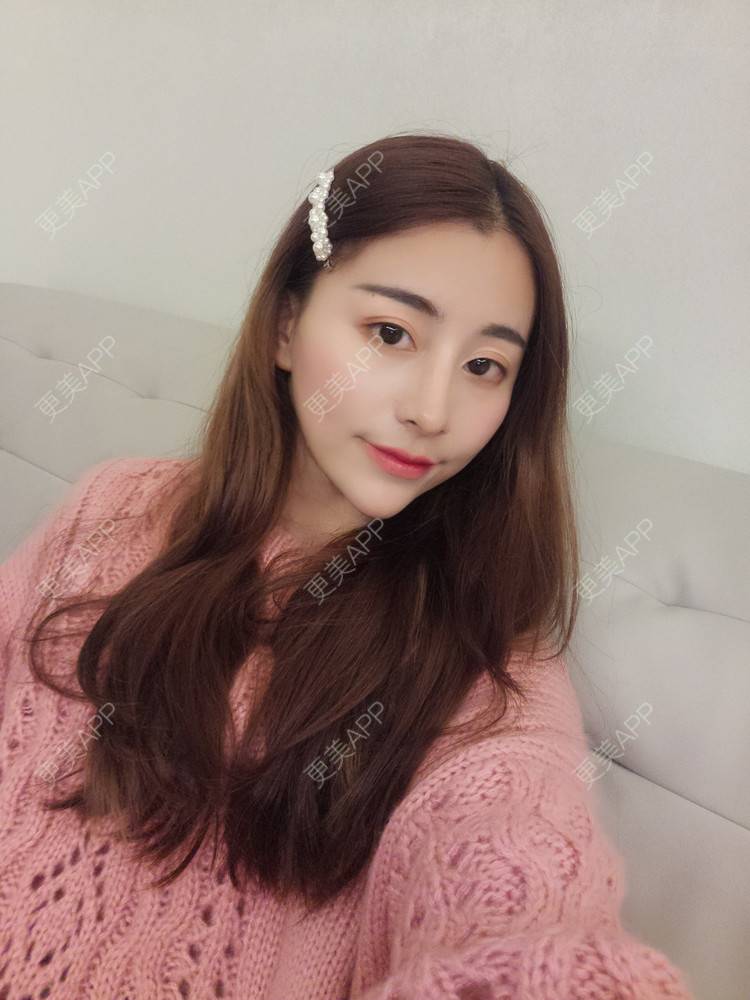 更美 - YOYO球的镭射净肤经验 | 镭射净肤 | 广州