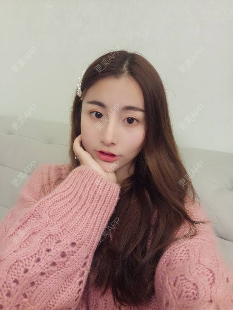 更美 - YOYO球的镭射净肤经验 | 镭射净肤 | 广州