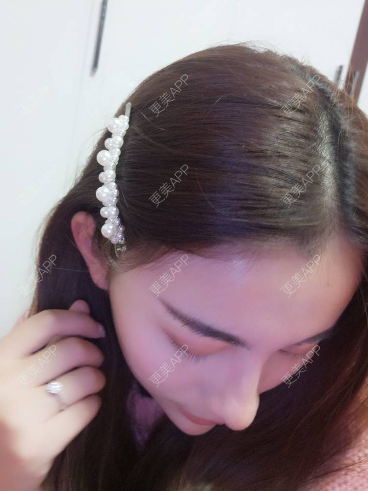 更美 - YOYO球的镭射净肤经验 | 镭射净肤 | 广州