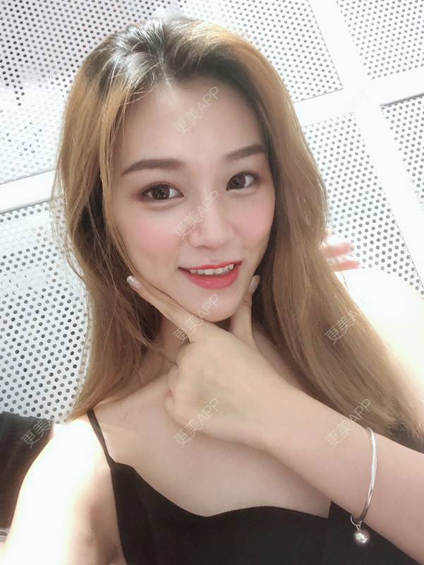 更美 - 更美用户QgvqVyY1q0的硅胶隆鼻经验 | 硅胶隆鼻 | 肋软骨隆鼻 | 杭州