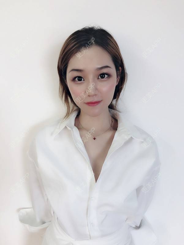 更美 - 更美用户QgvqVyY1q0的硅胶隆鼻经验 | 硅胶隆鼻 | 肋软骨隆鼻 | 杭州