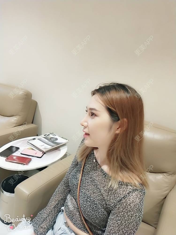更美 - 更美用户QgvqVyY1q0的硅胶隆鼻经验 | 硅胶隆鼻 | 肋软骨隆鼻 | 杭州