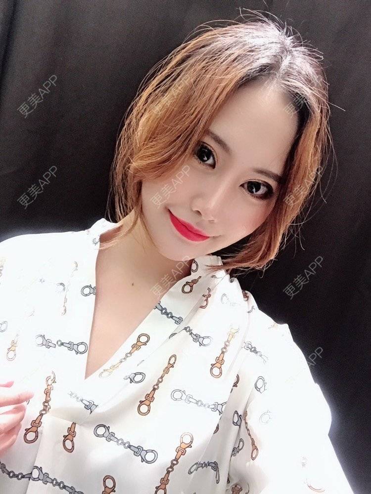 更美 - 徐利刚 医生的鼻部多项经验 | 视频日记 | 杭州 | 鼻部多项