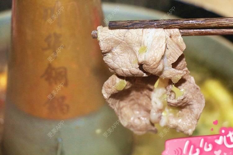 更美 - 经历了事，看懂了你的阴唇整形经验 | 阴唇整形 | 上海