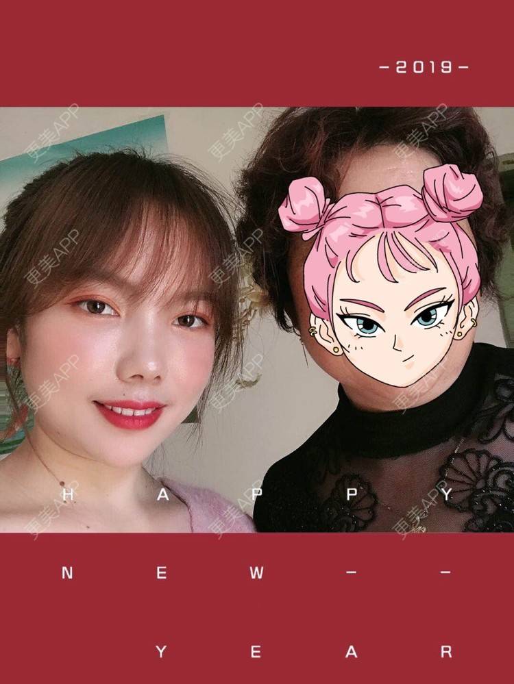 更美 - Amnot的自体脂肪丰面颊经验 | 自体脂肪丰面颊 | 自体脂肪丰太阳穴 | 重庆