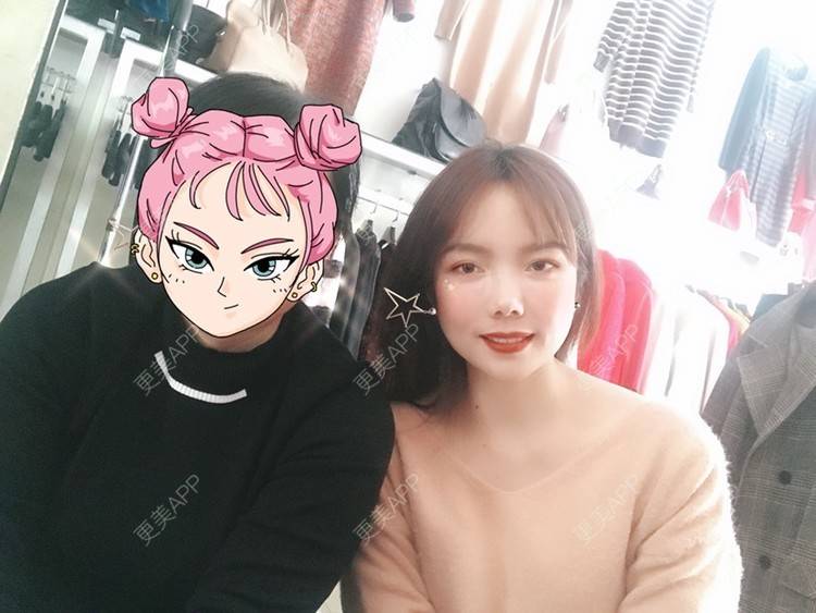 更美 - Amnot的自体脂肪丰面颊经验 | 自体脂肪丰面颊 | 自体脂肪丰太阳穴 | 重庆