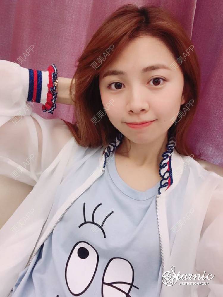 更美 - 💋夕夕💕的手臂脱毛经验 | 大腿脱毛 | 手臂脱毛 | 深圳
