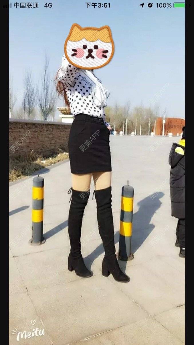 更美 - 文文美臀的自体脂肪丰臀经验 | 自体脂肪丰臀
