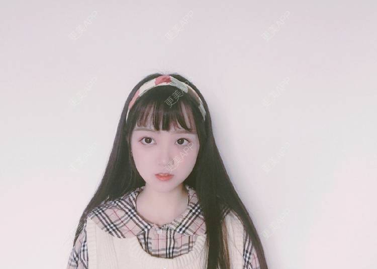 更美 - 桃子玖的冷光美白经验 | 成都 | 冷光美白