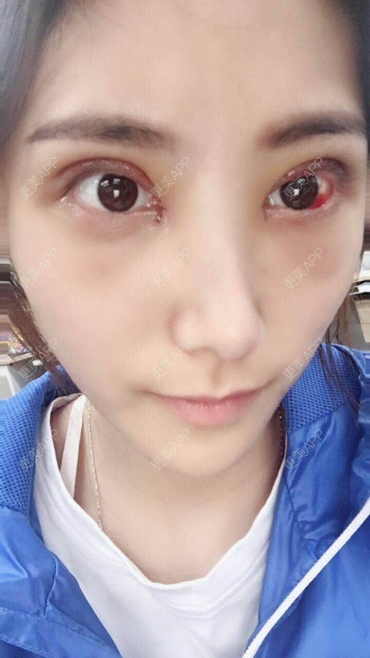 双色彩虹的眼部综合日记