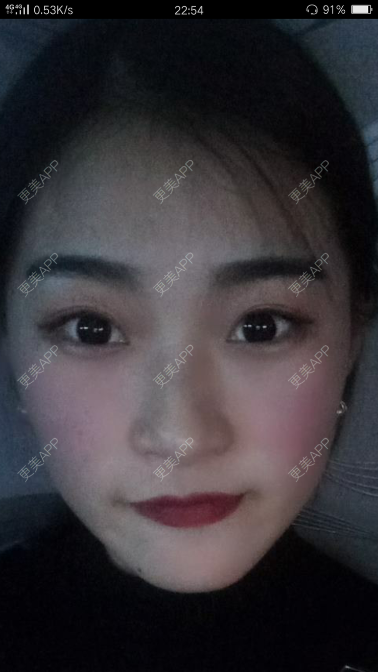 更美 - 刘刚 医生的鼻部多项经验 | 鼻部多项 | 哈尔滨
