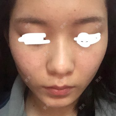 面部轮廓