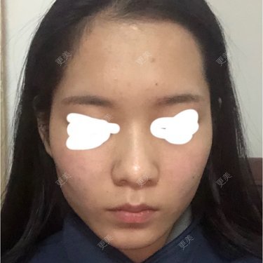 面部轮廓