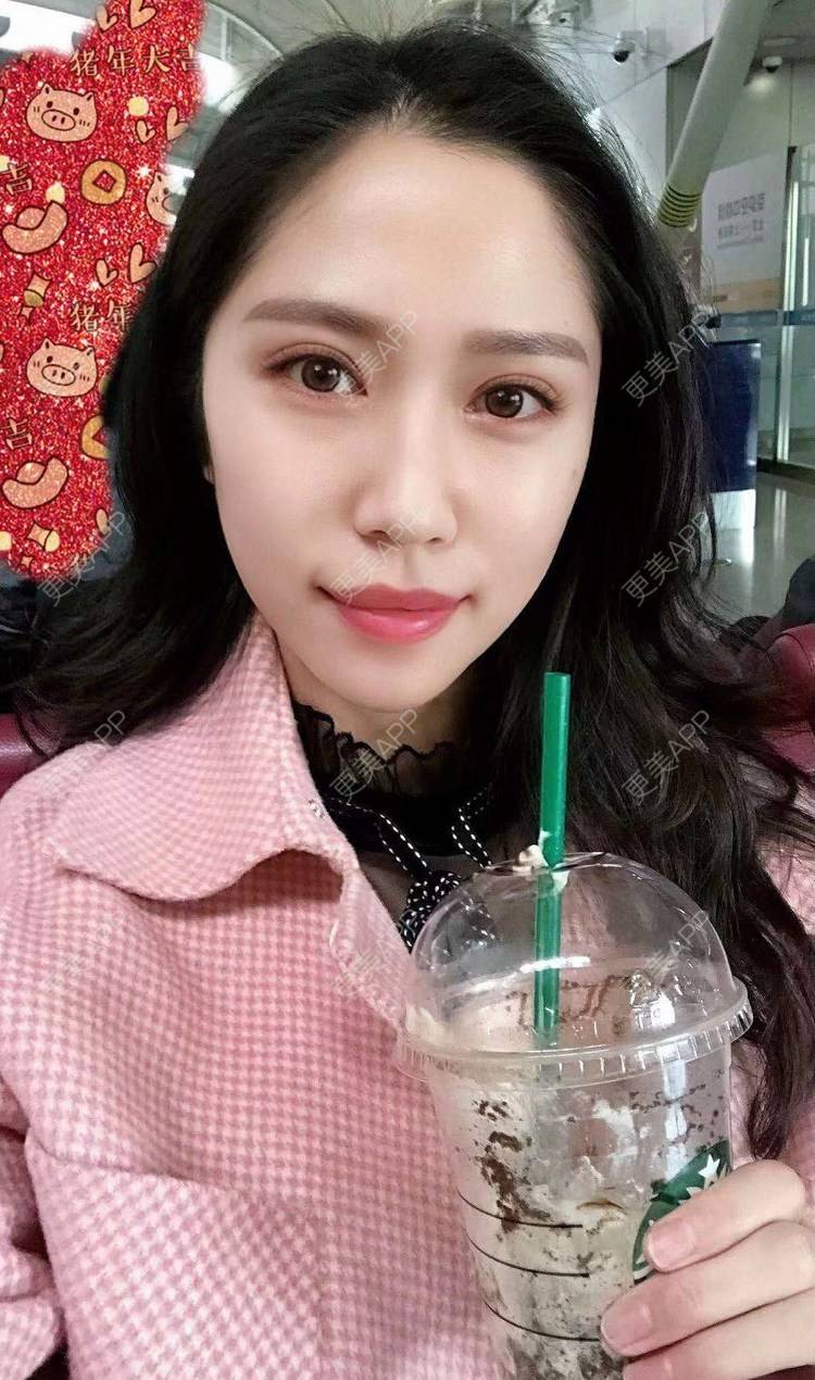 更美 - 枫叶上的小灰猫的膨体垫下巴经验 | 上海 | 视频日记 | 膨体垫下巴