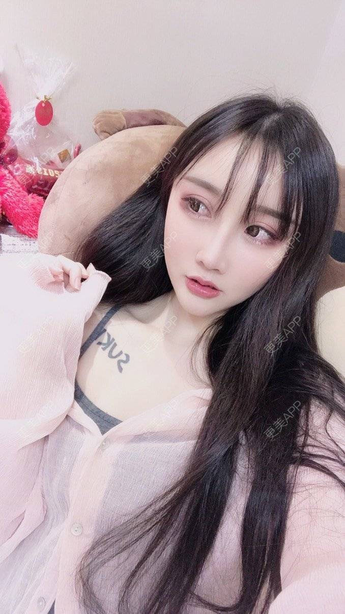 更美 - MeYou00的自体脂肪丰苹果肌经验 | 自体脂肪丰苹果肌 | 自体脂肪丰面颊 | 自体脂肪丰太阳穴 | 自体脂肪丰额头 | 杭州 | 自体脂肪全面部填充