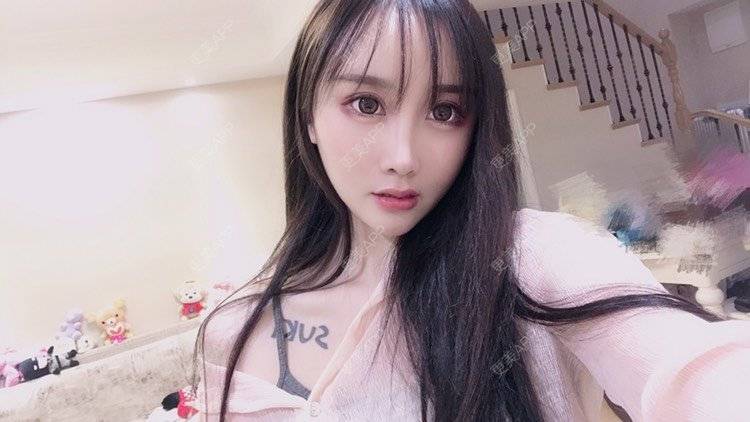 更美 - MeYou00的自体脂肪丰苹果肌经验 | 自体脂肪丰苹果肌 | 自体脂肪丰面颊 | 自体脂肪丰太阳穴 | 自体脂肪丰额头 | 杭州 | 自体脂肪全面部填充