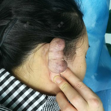 疯子也有疯子旳情调林