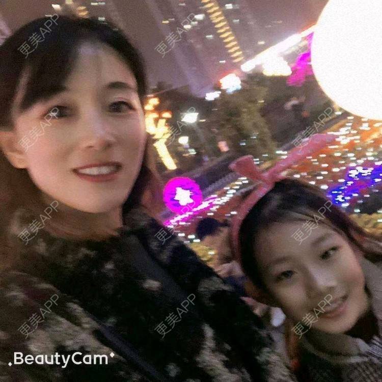 更美 - 更美用户jz7uDI5DsY的树脂补牙经验 | 树脂补牙 | 重庆