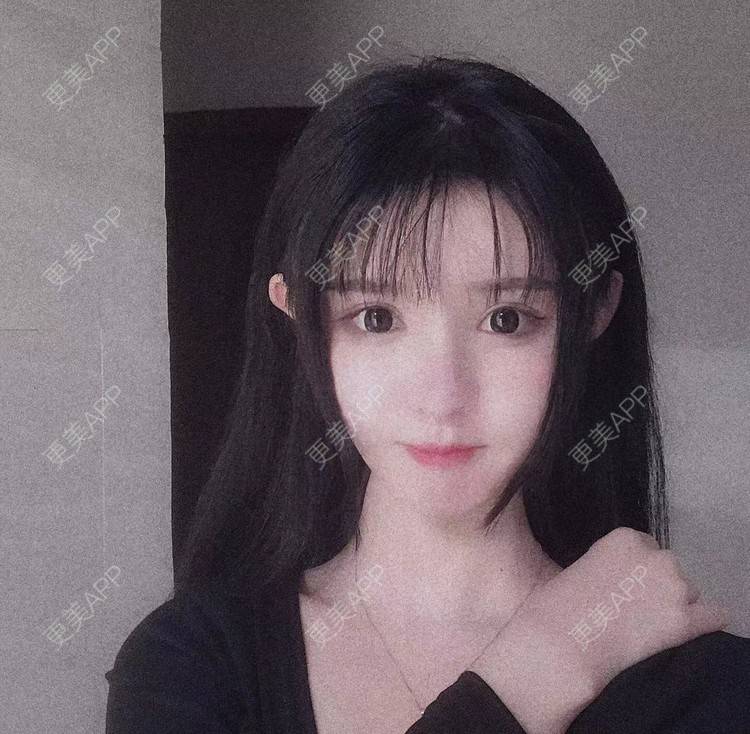 更美 - 老街上的猫的吸脂瘦脸经验 | 吸脂瘦脸 | 南昌