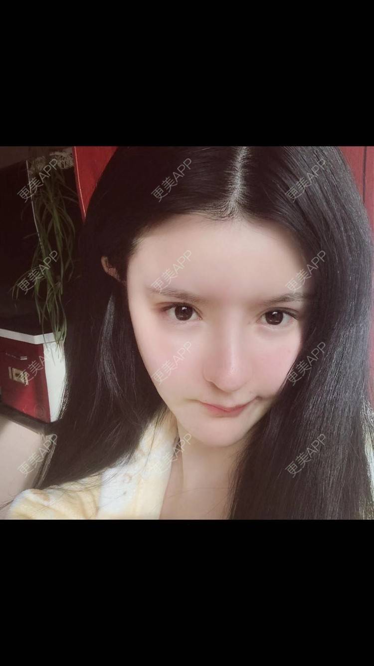 更美 - 老街上的猫的吸脂瘦脸经验 | 吸脂瘦脸 | 南昌