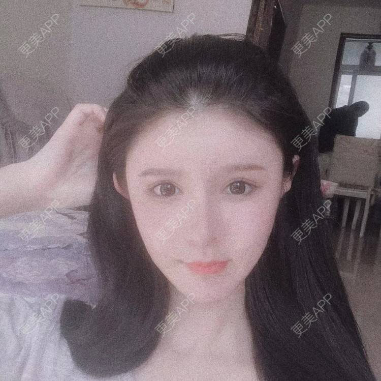 更美 - 老街上的猫的吸脂瘦脸经验 | 吸脂瘦脸 | 南昌