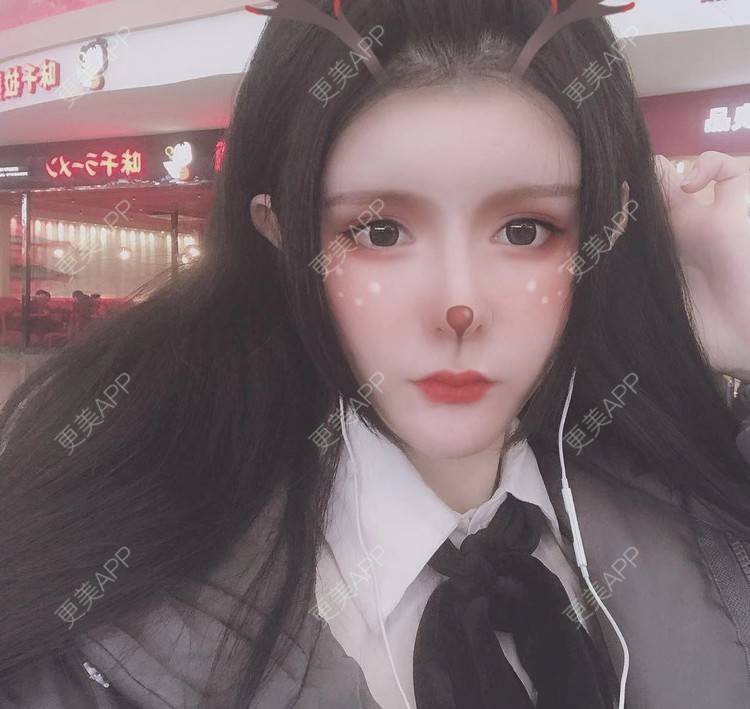 更美 - 老街上的猫的吸脂瘦脸经验 | 吸脂瘦脸 | 南昌