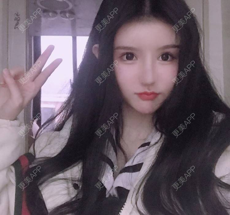 更美 - 老街上的猫的吸脂瘦脸经验 | 吸脂瘦脸 | 南昌