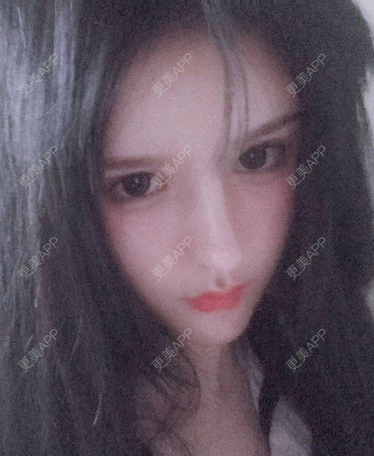 更美 - 老街上的猫的吸脂瘦脸经验 | 吸脂瘦脸 | 南昌