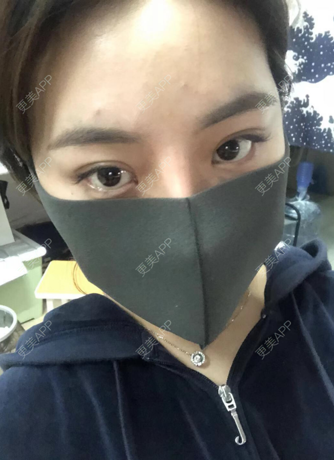 更美 - 疯女子爱爱逛的厚唇改薄经验 | 成都 | 厚唇改薄