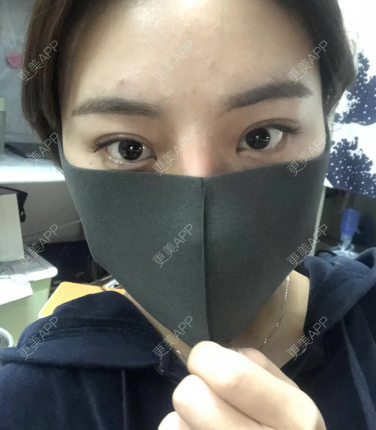 更美 - 疯女子爱爱逛的厚唇改薄经验 | 成都 | 厚唇改薄