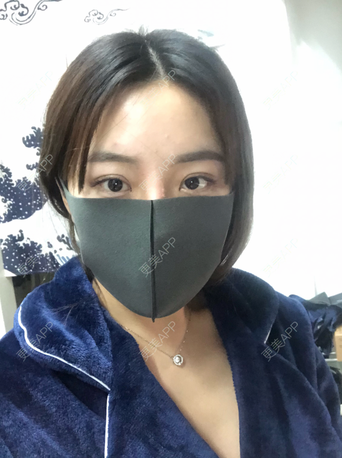 更美 - 疯女子爱爱逛的厚唇改薄经验 | 成都 | 厚唇改薄