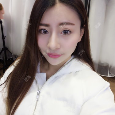 YOYO球
