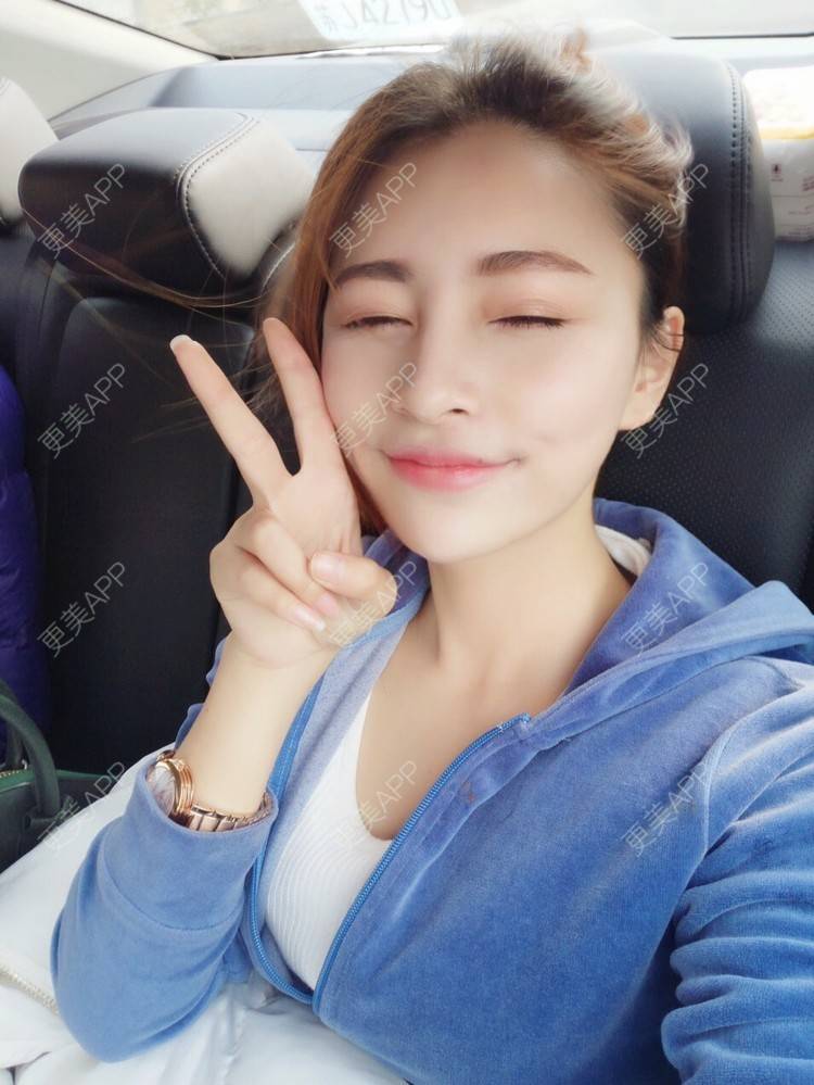 更美 - YOYO球的镭射净肤经验 | 广州 | 镭射净肤
