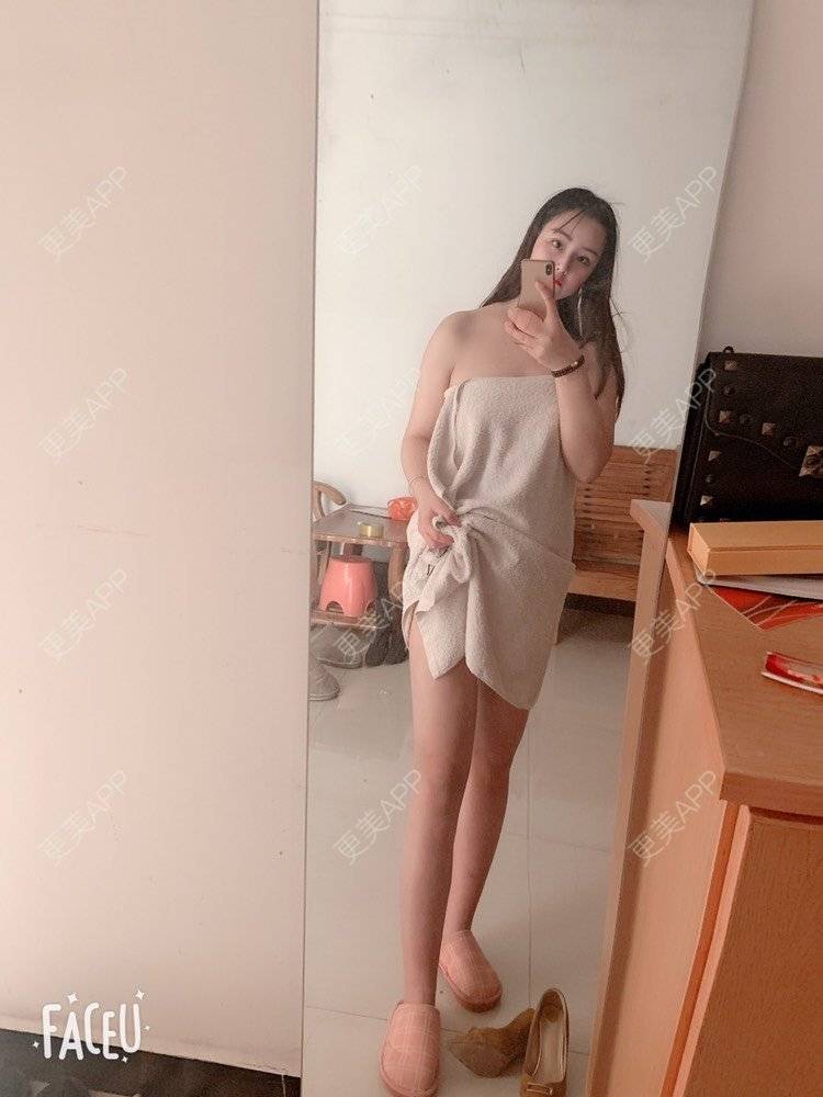 更美 - 凑热闹的逗比的吸脂瘦大腿经验 | 吸脂瘦大腿 | 黄冈