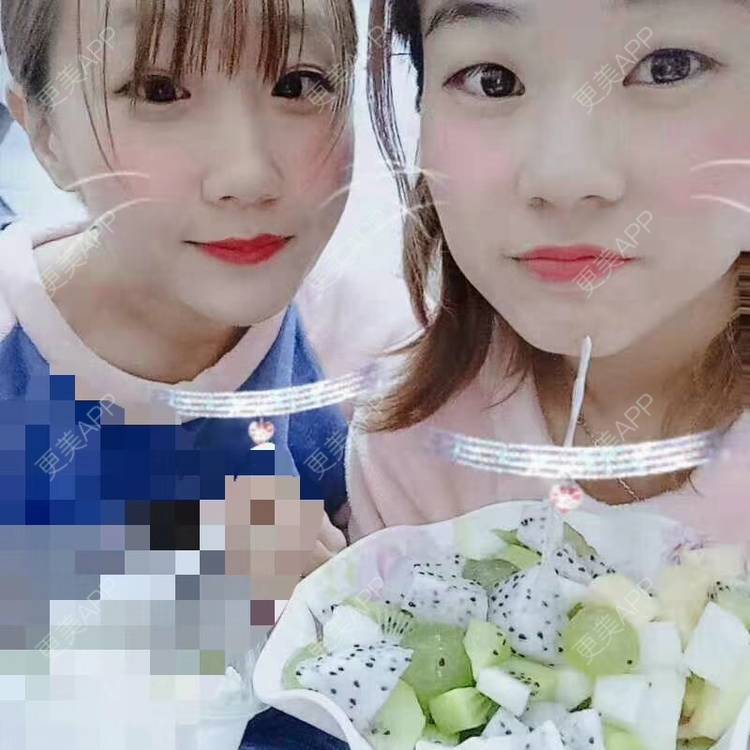 更美 - 我高冷的树脂补牙经验 | 重庆 | 树脂补牙