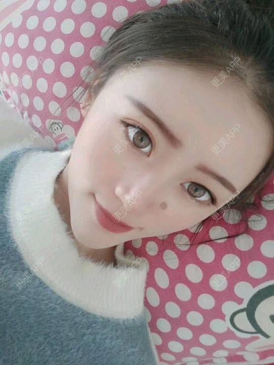 更美 - 更美用户jz7uDI5DsY的树脂补牙经验 | 树脂补牙 | 重庆