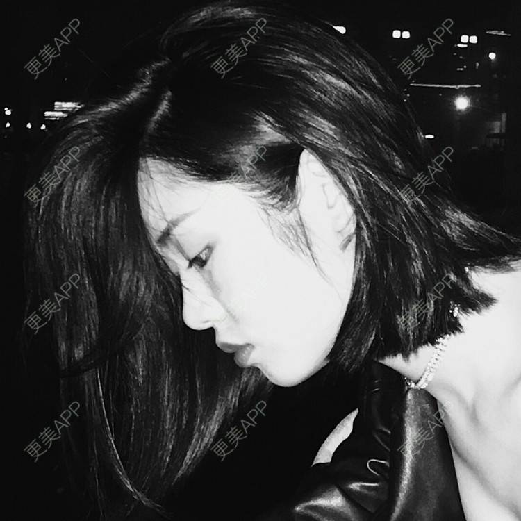 更美 - 天使般美丽的颧骨颧弓经验 | 颧骨内推 | 颧骨颧弓 | 武汉 | 面部不对称矫正 | 颧弓降低