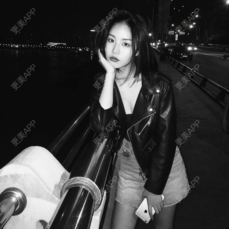 更美 - 天使般美丽的颧骨颧弓经验 | 颧骨内推 | 颧骨颧弓 | 武汉 | 面部不对称矫正 | 颧弓降低