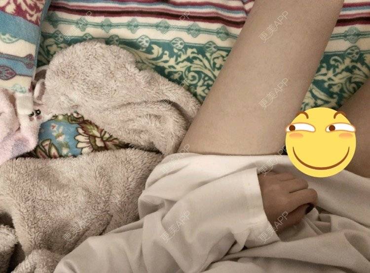 更美 - 好好心情的腰腹吸脂经验 | 腰腹吸脂 | 背部吸脂 | 吸脂瘦大腿 | 手臂吸脂 | 杭州