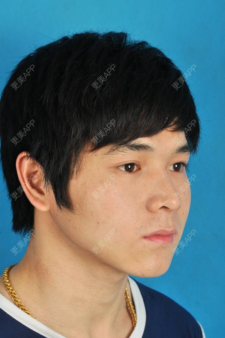 更美用户iaso7rvctm的下颌角日记