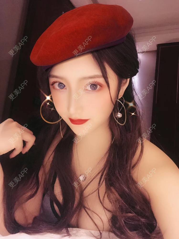 更美 - 小晴晴宝宝的眼皮下垂矫正经验 | 视频日记 | 眼皮下垂矫正 | 广州