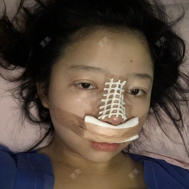 更美用户JMQLbybsLF